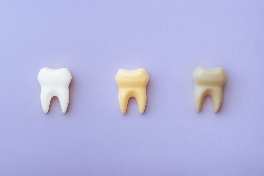 Three teeth in different shades